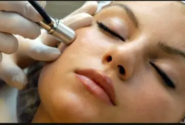 Microdermabrasion